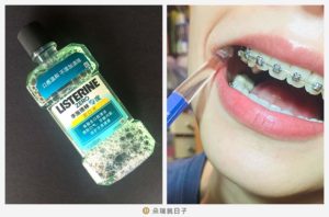 矯正牙齒清潔工具-漱口水